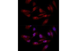 Confocal immunofluorescence analysis of U-2OS cells using EIF6 antibody (ABIN3022602, ABIN3022603, ABIN3022604 and ABIN6218936) at dilution of 1:50. (EIF6 antibody  (AA 1-245))