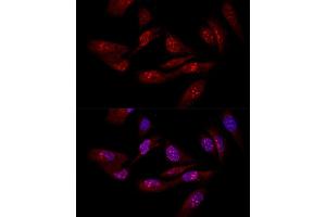Confocal immunofluorescence analysis of U-2OS cells using EIF6 antibody (ABIN3022602, ABIN3022603, ABIN3022604 and ABIN6218936) at dilution of 1:50.