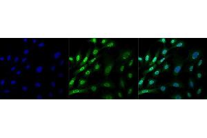 Immunocytochemistry/Immunofluorescence analysis using Mouse Anti-Ubiquitin Monoclonal Antibody, Clone FK1 (ABIN5024440). (Ubiquitin antibody  (Atto 488))