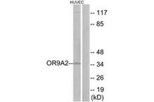 Western blot analysis of extracts from HuvEc cells, using OR9A2 Antibody. (OR9A2 antibody  (AA 260-309))