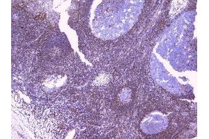IHC analysis of PBP using anti-PBP antibody (ABIN5693043).