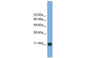 WB Suggested Anti-COMMD8 Antibody Titration: 0. (COMMD8 antibody  (Middle Region))