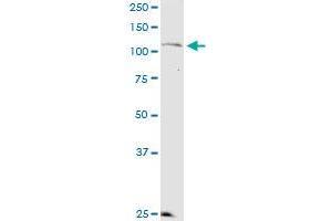 KSR2 monoclonal antibody (M08), clone 1G4. (KSR2 antibody  (AA 411-500))