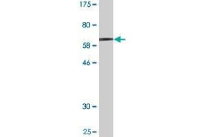 Western Blot detection against Immunogen (60. (MAGEA11 antibody  (AA 1-319))