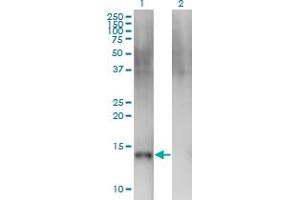 Western Blot analysis of SEMA4B expression in transfected 293T cell line by SEMA4B monoclonal antibody (M03), clone 4B2.
