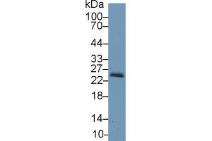 Western blot analysis of Mouse Kidney lysate, using Mouse RBP4 Antibody (1 µg/ml) and HRP-conjugated Goat Anti-Rabbit antibody ( (RBP4 antibody  (AA 63-245))