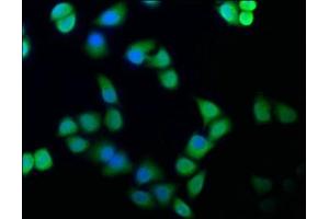 Immunofluorescence staining of Hela cells with ABIN7152321 at 1:100, counter-stained with DAPI. (Exportin 2 antibody  (AA 713-971))