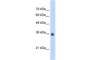 Western Blotting (WB) image for anti-Stromal Cell Derived Factor 4 (SDF4) antibody (ABIN2463052) (SDF4 antibody)