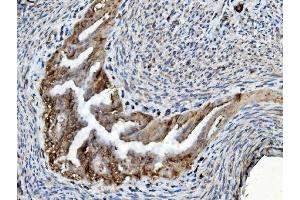 IHC analysis of PDIA6 using anti-PDIA6 antibody (ABIN7600553). (PDIA6 antibody  (AA 20-440))