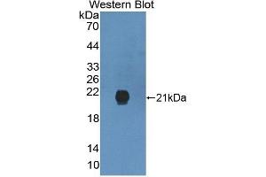 Detection of Recombinant GREM2, Human using Polyclonal Antibody to Gremlin 2 (GREM2) (GREM2 antibody  (AA 22-168))