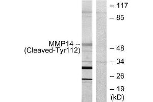 Western Blotting (WB) image for anti-Matrix Metallopeptidase 14 (Membrane-inserted) (MMP14) (Cleaved-Tyr112) antibody (ABIN1853593) (MMP14 antibody  (Cleaved-Tyr112))