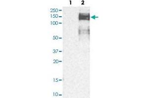 Western blot analysis of Lane 1: Human cell line RT-4; Lane 2: Human cell line U-251MG sp with ZEB1 polyclonal antibody  at 1:250-1:500 dilution.