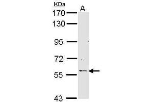 WB Image Sample (30 ug of whole cell lysate) A: Hep G2 , 7. (RCBTB2 antibody)