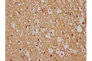 IHC image of ABIN7175445 diluted at 1:200 and staining in paraffin-embedded human brain tissue performed on a Leica BondTM system. (PTPLAD1 antibody  (AA 1-145))