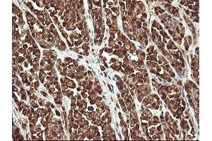 Image no. 5 for anti-Proline Synthetase Co-Transcribed (PROSC) antibody (ABIN1500440)