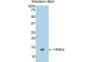 Detection of Recombinant REG1a, Human using Polyclonal Antibody to Regenerating Islet Derived Protein 1 Alpha (REG1a)