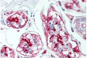 Human Skin, Sweat Glands (formalin-fixed, paraffin-embedded) stained with CD59 antibody ABIN298471 at 5 ug/ml followed by biotinylated anti-mouse IgG secondary antibody ABIN481714, alkaline phosphatase-streptavidin and chromogen. (CD59 antibody)