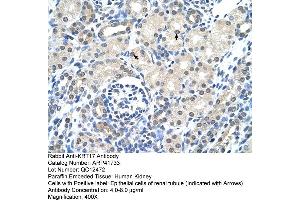 Rabbit Anti-KRT17 Antibody  Paraffin Embedded Tissue: Human Kidney Cellular Data: Epithelial cells of renal tubule Antibody Concentration: 4. (KRT17 antibody  (C-Term))