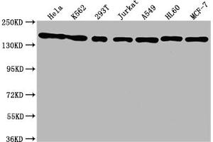 Western Blot Positive WB detected in: Hela whole cell lysate, K562 whole cell lysate, 293T whole cell lysate, Jurkat whole cell lysate, A549 whole cell lysate, HL60 whole cell lysate, MCF-7 whole cell lysate All lanes: SMC1A antibody at 1:1500 Secondary Goat polyclonal to rabbit IgG at 1/50000 dilution Predicted band size: 144 kDa Observed band size: 144 kDa (Recombinant SMC1A antibody)