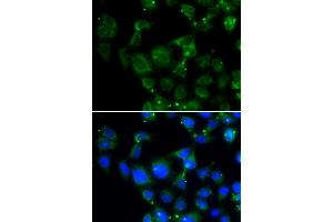 Immunofluorescence analysis of HeLa cells using MAPRE2 antibody (ABIN5974001). (MAPRE2 antibody)