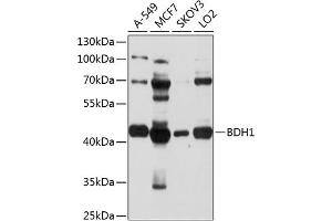 Western blot analysis of extracts of various cell lines, using BDH1 antibody (ABIN1678849, ABIN3018068, ABIN3018069 and ABIN6220349) at 1:1000 dilution. (BDH1 antibody  (AA 1-343))