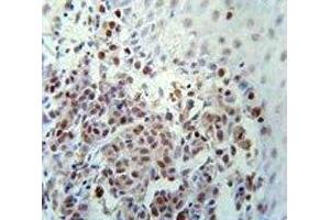 Immunohistochemistry (IHC) image for anti-X-Ray Repair Complementing Defective Repair in Chinese Hamster Cells 1 (XRCC1) (AA 407-435) antibody (ABIN3029645)