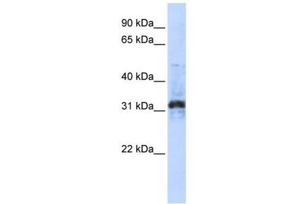ZNF705D antibody