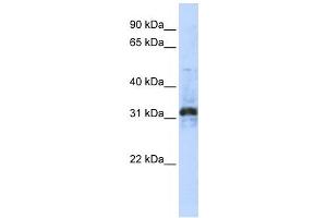 Western Blotting (WB) image for anti-Zinc Finger Protein 705D (ZNF705D) antibody (ABIN2459412) (ZNF705D antibody)