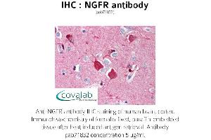 Image no. 2 for anti-Nerve Growth Factor Receptor (NGFR) antibody (ABIN1737340) (NGFR antibody)