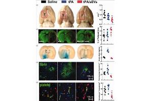 The effect of CEC-sEVs/tPA on thrombosis and BBB leakage. (Collagenase Type 3)