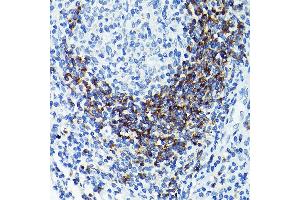 Immunohistochemistry (IHC) image for anti-CD79b Molecule, Immunoglobulin-Associated beta (CD79B) (AA 29-159) antibody (ABIN3022746)