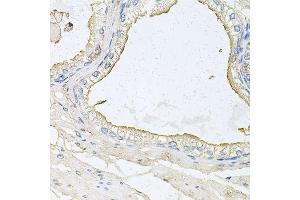 Immunohistochemistry of paraffin-embedded human prostate using HPR antibody (ABIN6003630) at dilution of 1/100 (40x lens). (HPR antibody)