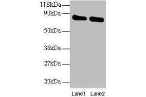 Western blot All lanes: OTUB1 antibody at 2 μg/mL Lane 1: EC109 whole cell lysate Lane 2: 293T whole cell lysate Secondary Goat polyclonal to rabbit IgG at 1/15000 dilution Predicted band size: 32, 36 kDa Observed band size: 80 kDa (OTUB1 antibody  (AA 2-201))