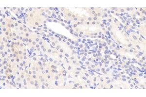 Detection of SOST in Human Kidney Tissue using Polyclonal Antibody to Sclerostin (SOST) (Sclerostin antibody  (AA 25-213))
