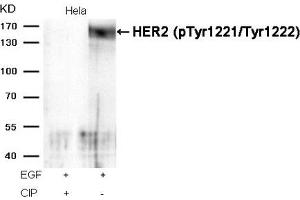 Western blot analysis of extracts from Hela cells, treated with EGF or calf intestinal phosphatase (CIP), using HER2 (Phospho-Tyr1221/Tyr1222) Antibody. (ErbB2/Her2 antibody  (pTyr1221, pTyr1222))