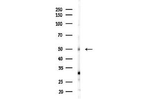 anti-Zinc Finger Protein 71 (ZNF71) (N-Term) antibody