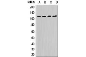 Western blot analysis of PI3K p110 delta expression in K562 (A), Raji (B), Raw264. (PIK3CD antibody  (C-Term))