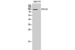 Western Blotting (WB) image for anti-Discs, Large Homolog 2 (DLG2) (Internal Region) antibody (ABIN3186576) (DLG2 antibody  (Internal Region))