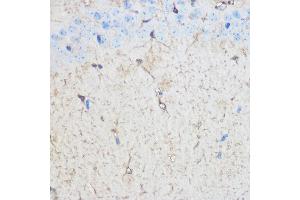 Immunohistochemistry of paraffin-embedded Mouse brain using S100B Rabbit pAb (ABIN3021047, ABIN3021048, ABIN3021049, ABIN1513496 and ABIN6213928) at dilution of 1:100 (40x lens). (S100B antibody  (AA 1-92))