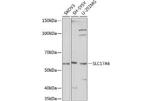 Western blot analysis of extracts of various cell lines, using SLC17 Polyclonal Antibody (ABIN7270407) at 1:1000 dilution. (Solute Carrier Family 17 (Vesicular Glutamate Transporter), Member 6 (SLC17A6) (C-Term) antibody)