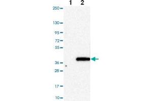 Western blot analysis of Lane 1: Negative control (vector only transfected HEK293T lysate) Lane 2: Over-expression Lysate (Co-expressed with a C-terminal myc-DDK tag (~3.