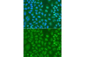 Immunofluorescence analysis of HeLa cells using CXXC1 antibody. (CXXC1 antibody)
