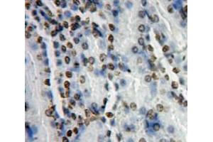 Used in DAB staining on fromalin fixed paraffin-embedded kidney tissue (ATF7 antibody  (AA 234-436))