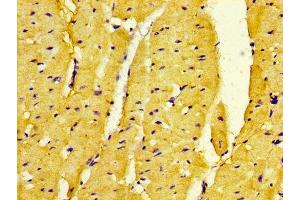 IHC image of ABIN7160623 diluted at 1:500 and staining in paraffin-embedded human heart tissue performed on a Leica BondTM system. (DMPK antibody  (AA 243-424))