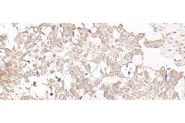 Espin antibody