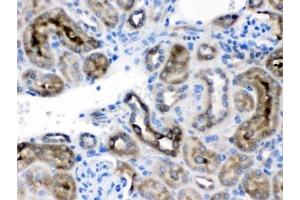 IHC testing of FFPE mouse kidney with TCP1 delta antibody.
