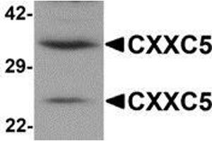 Western blot analysis of CXXC5 in human brain tissue lysate with CXXC5 antibody at 1 μg/ml.