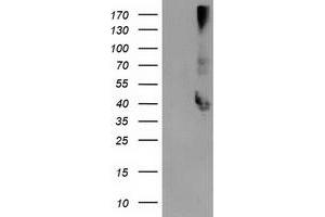Western Blotting (WB) image for anti-Microtubule-Associated Protein, RP/EB Family, Member 2 (MAPRE2) antibody (ABIN1499318) (MAPRE2 antibody)