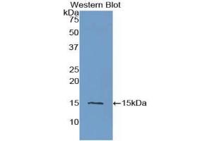 Detection of Recombinant CST3, Human using Polyclonal Antibody to Cystatin C (Cys-C) (CST3 antibody  (AA 27-146))