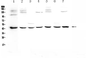 Western blot analysis of WWOX using anti-WWOX antibody . (WWOX antibody  (AA 1-245))